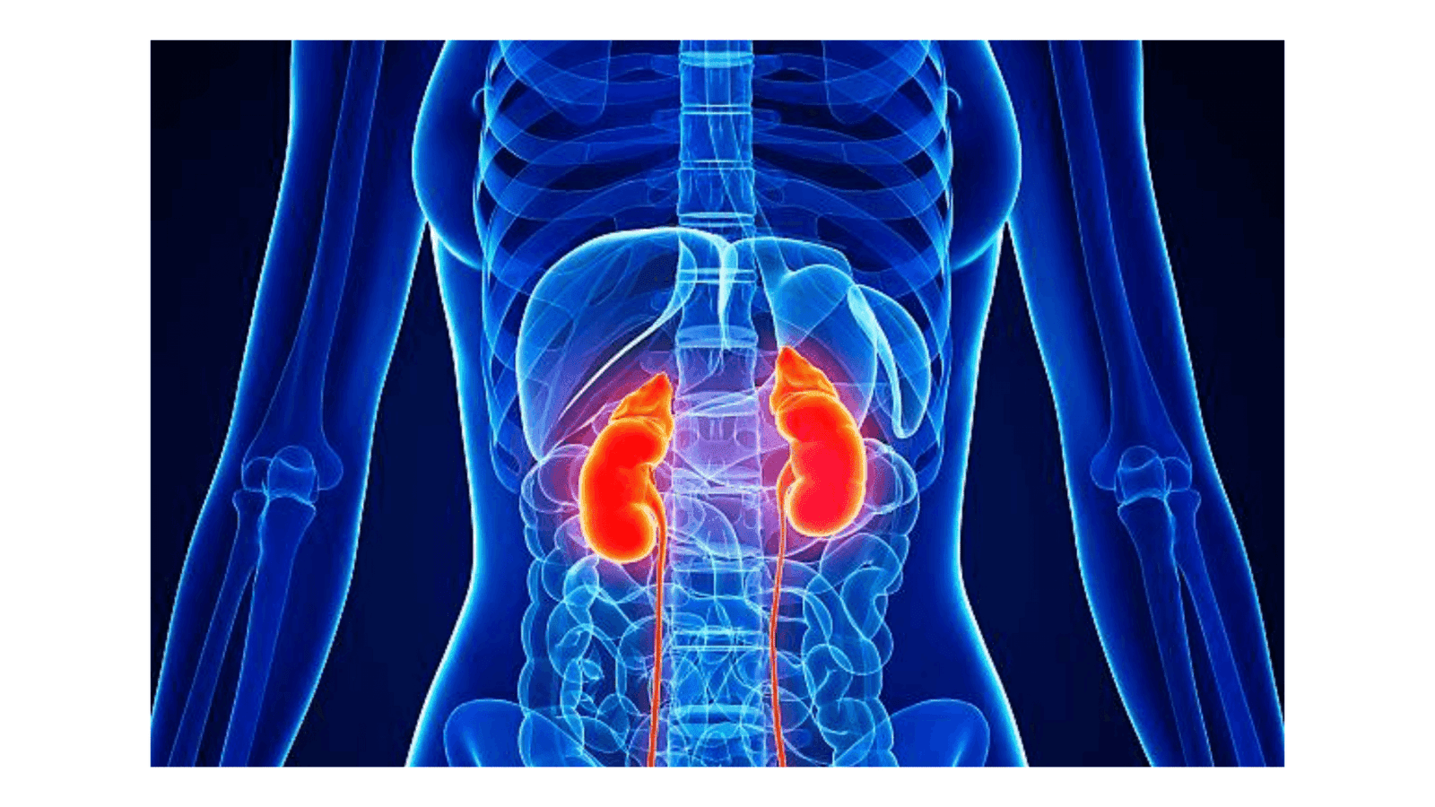 Kidney Disease