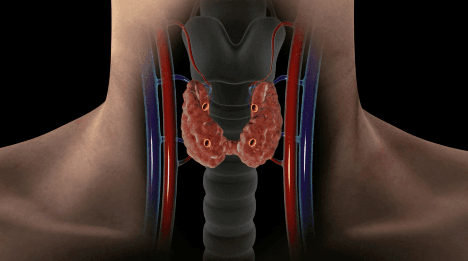 Thyroid Nodules & Cancer